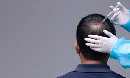 Transplantasi Rambut Gagal? Dokter Ungkap Penyebab Utama
